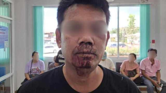 Bị cáo buộc xâm hại nữ sinh 14 tuổi, thầy giáo ở Thái Lan rút súng bắn tử vong người thân của cô bé- Ảnh 1.