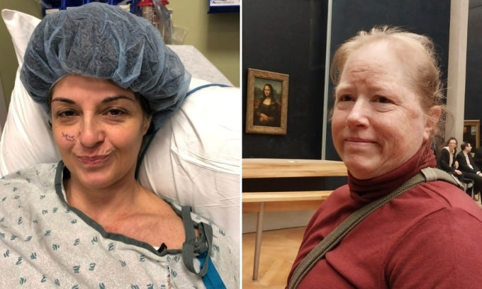 Jennifer Sontag (trái) và Amy Willard, những người đã quyết định rời khỏi Mỹ vì không chịu nổi áp lực từ chi phí y tế quá cao. Ảnh: Washington Post