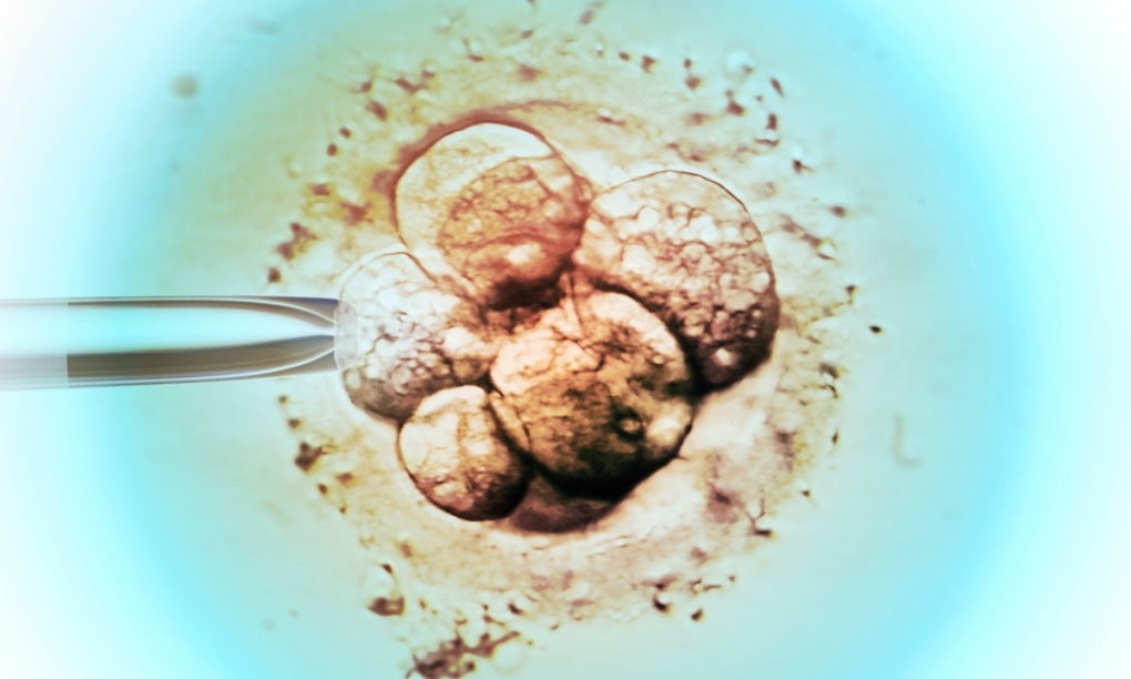 Quy trình lựa chọn phôi để thụ tinh trong ống nghiệm (IVF). Ảnh: Science Photo Library