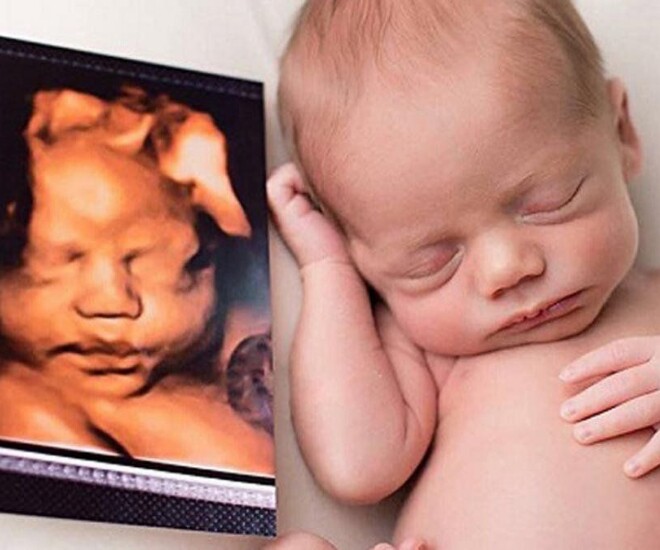 Siêu âm hình thái vừa giúp theo dõi sức khoẻ của thai nhi vừa giúp bố mẹ được gặp con yêu.