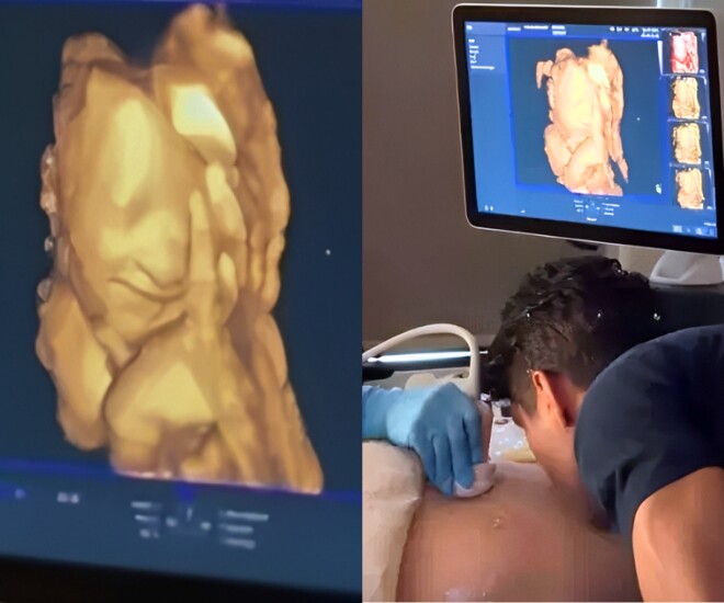 Khoảnh khắc em bé mỉm cười khi nghe giọng bố hút 50 triệu lượt xem.