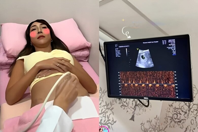 Dù đã có kinh nghiệm bầu bí, người đẹp vẫn hồi hộp khi đi siêu âm.