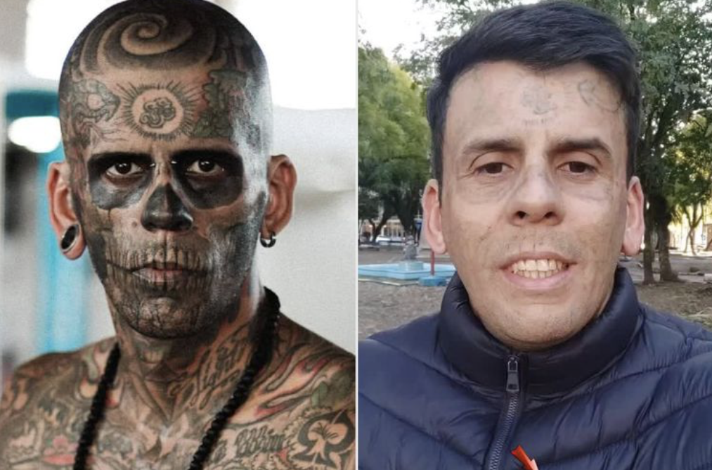 Vẻ ngoài của Leandro de Souza trước và sau khi xóa xăm hôm 28/8. Ảnh: Leandro de Souza/Instagram