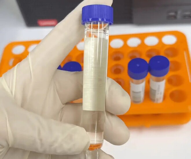 Sản phụ 37 tuổi có nhiều dấu hiệu mang thai nhưng đã bỏ qua.