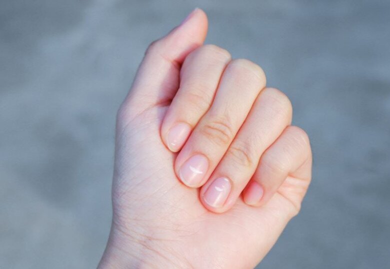 Bạn không nên chủ quan khi bề mặt móng tay xuất hiệu các đốm li ti (Ảnh minh hoạ)