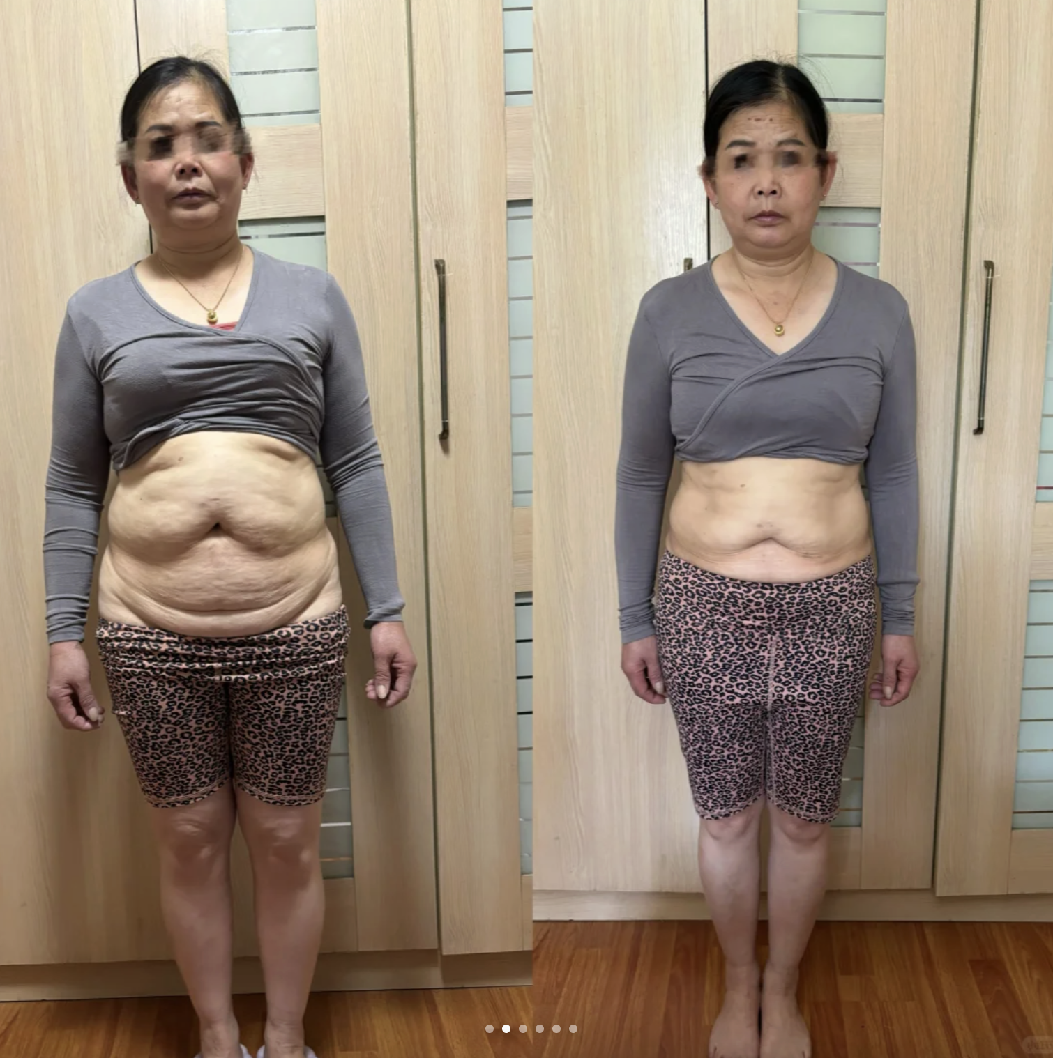 Phép màu giảm 8kg ở tuổi trung niên của bà mẹ 53 tuổi: Vượt giai đoạn trì trệ, bật công tắc đốt mỡ- Ảnh 2. Phép màu giảm 8kg ở tuổi trung niên của bà mẹ 53 tuổi: Vượt giai đoạn trì trệ, bật công tắc đốt mỡ- Ảnh 2.