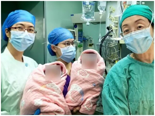 Cặp song sinh chào đời an toàn.