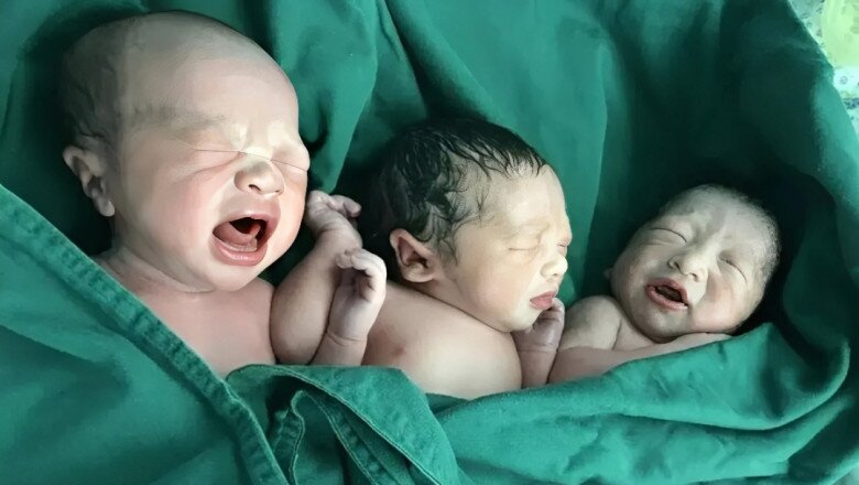 3 em bé chào đời khoẻ mạnh khiến gia đình và bác sĩ vỡ oà - Ảnh minh hoạ.