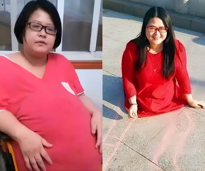 Chị Lữ Quyên được mệnh danh là người mẹ không chân, từng sinh đôi nhờ IVF.