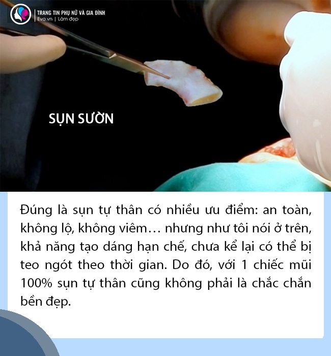 Sự thật không phải ai cũng tỏ: Nâng mũi quyết định chỉ 1% ở chất liệu - 5