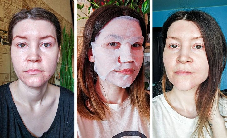 28 ngày đều đắp mặt nạ giấy, người phụ nữ có làn da lão hóa thay đổi khó tin - 11