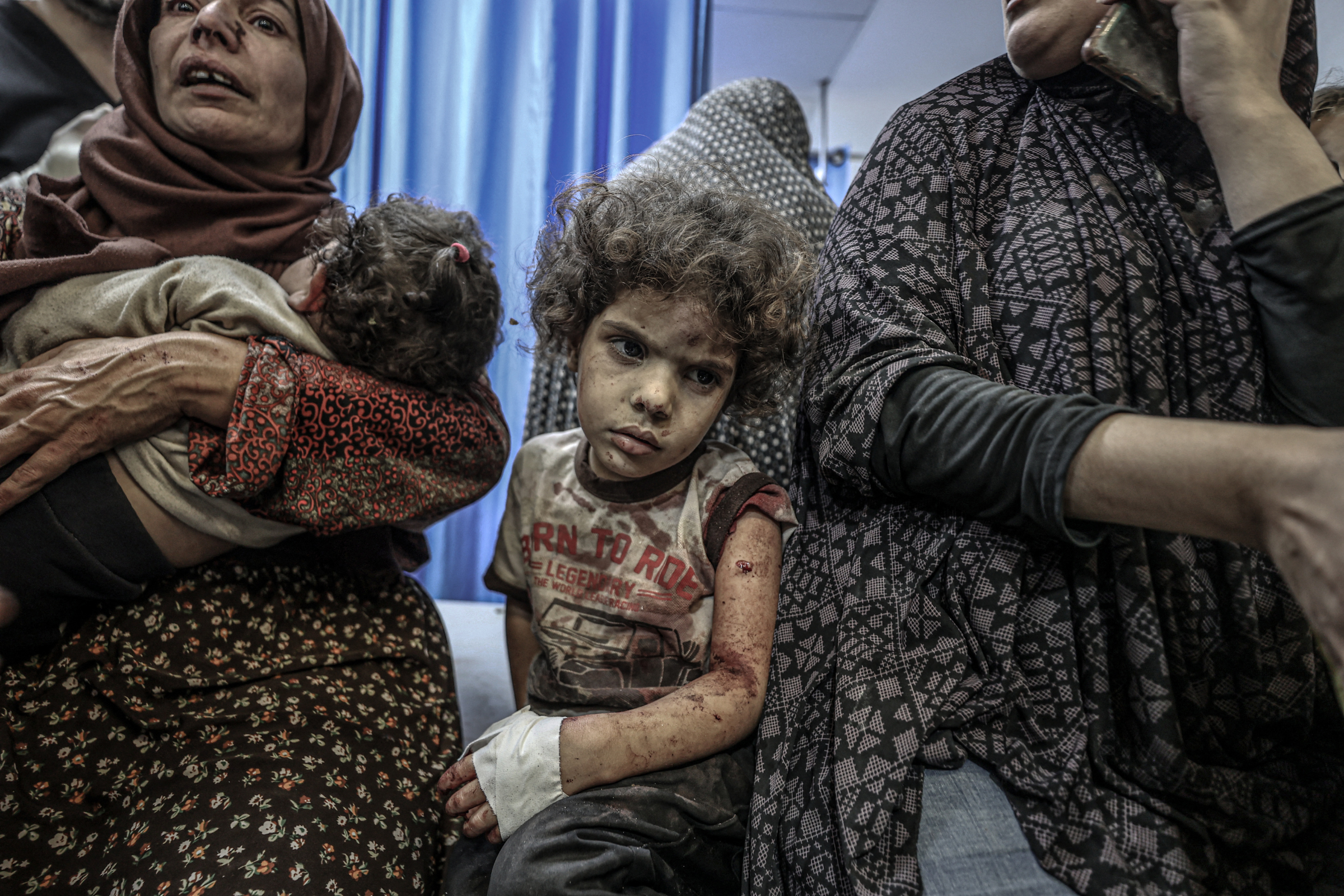 Trẻ em Palestine điều trị bên tại bệnh viện al-Shifa, Gaza, ngày 18/10. Ảnh: AFP