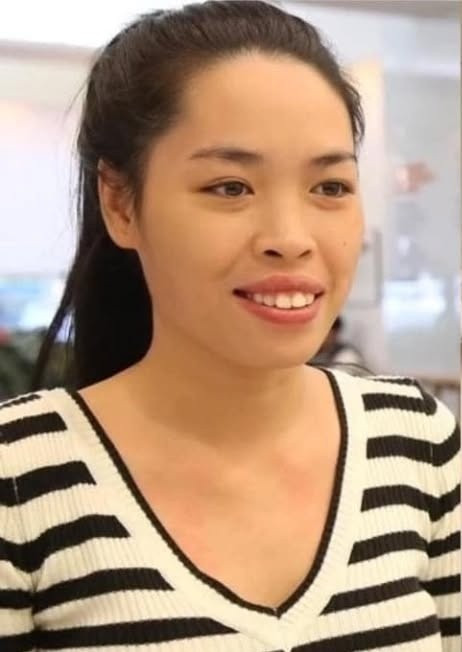 Nhờ chương trình, Vũ Thanh Quỳnh đã nhận được suất tài trợ phẫu thuật thẩm mỹ toàn diện tại Hàn Quốc. Cô trải qua một quá trình đau đớn và kiên nhẫn với nhiều ca phẫu thuật phức tạp như: cắt xương hàm, chỉnh hô, gọt cằm, nhấn mí mắt và nâng mũi.