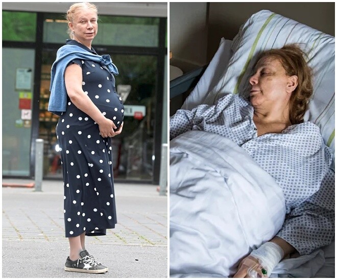 Bà mẹ mang thai và sinh con ở độ tuổi đã cao.