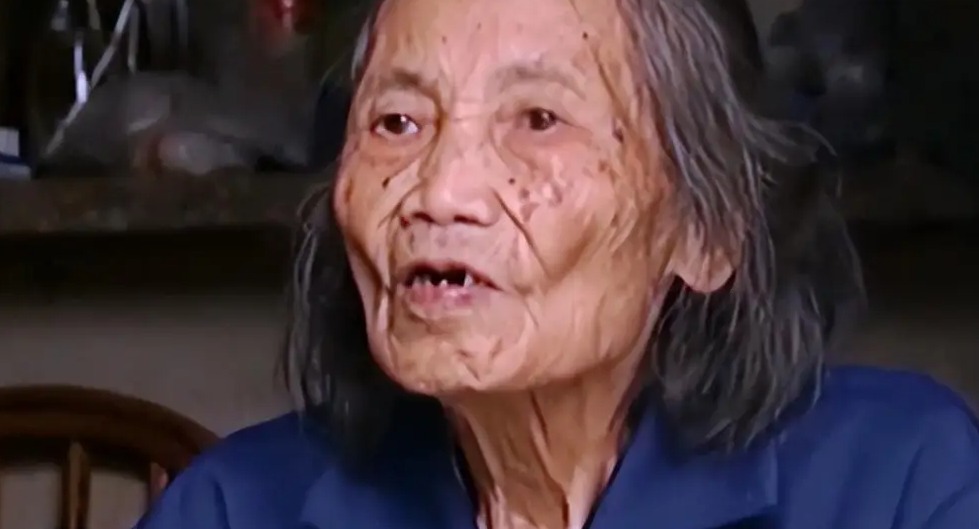Hoá ra bà cụ từng sảy thai cách đó 60 năm nhưng không phẫu thuật, nên thai nhi vẫn ở lại trong bụng.