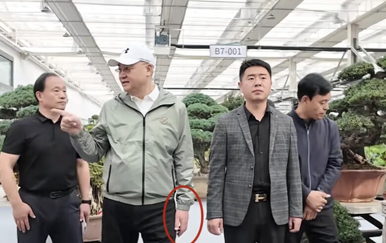 Ở góc khác, tay trái của nam diễn viên lại trở về trạng thái bình thường.