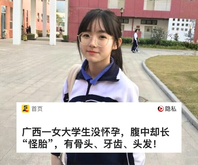 Nữ sinh đại học 19 tuổi đi khám sau khi phát hiện bụng phình to như đang mang thai - Ảnh minh hoạ.