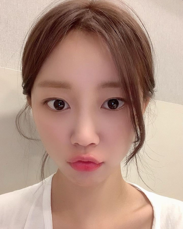 Rất nhiều chị em đang tẩy tế bào chết môi sai cách, bảo sao môi cứ tróc từng mảng - Ảnh 1. Rất nhiều chị em đang tẩy tế bào chết môi sai cách, bảo sao môi cứ tróc từng mảng - Ảnh 1.