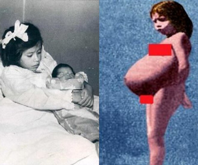 Lina 5 tuổi với chiếc bụng bầu lớn.