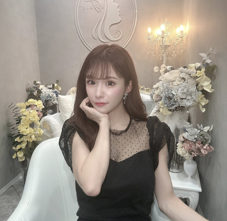 Cô gái amp;#34;vịt hóa thiên ngaamp;#34; sau khi chi 4 tỷ cho hơn 20 cuộc phẫu thuật, nhan sắc trước và sau thẩm mỹ khó tin nổi - 11