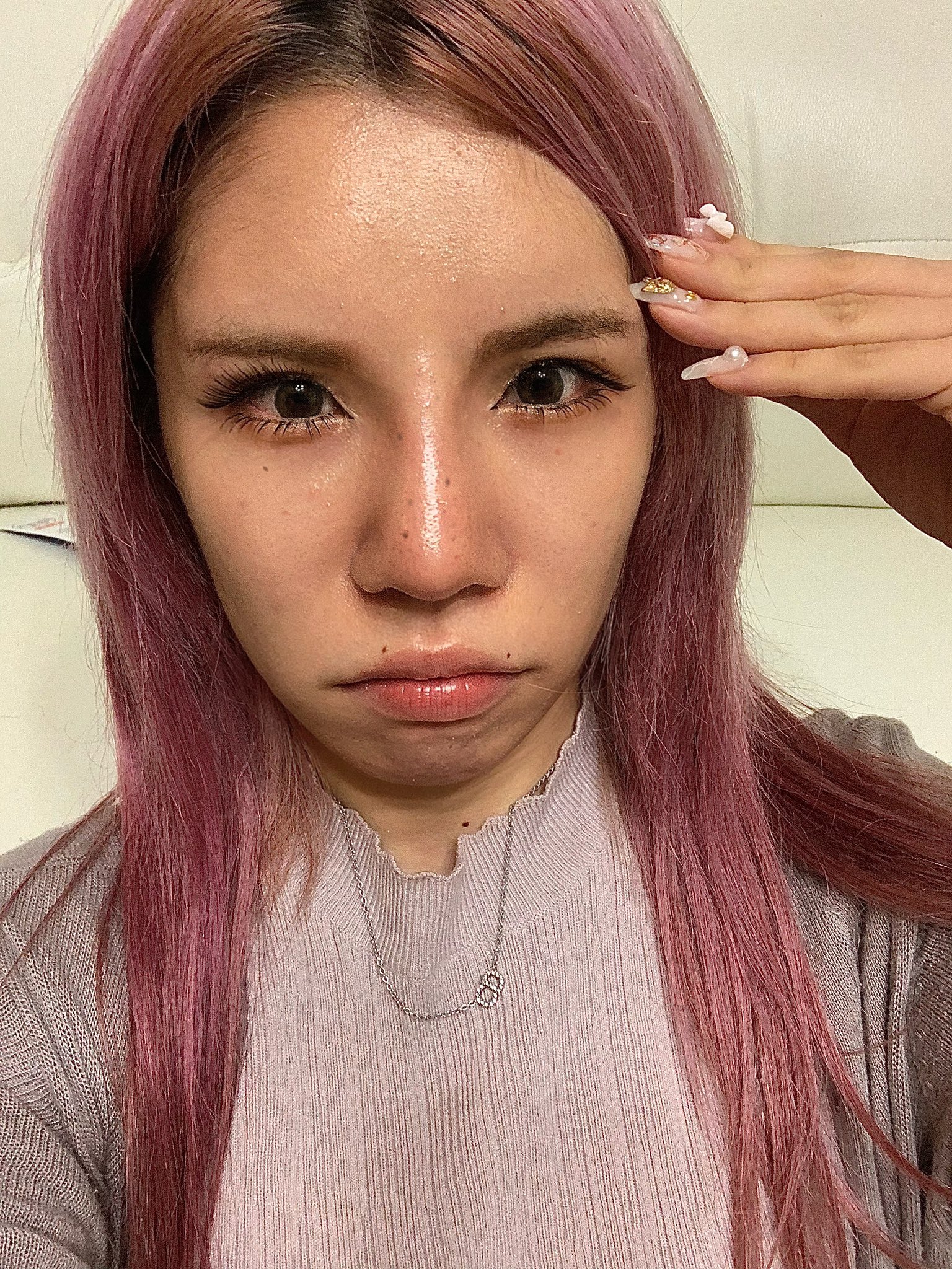 Cô gái amp;#34;vịt hóa thiên ngaamp;#34; sau khi chi 4 tỷ cho hơn 20 cuộc phẫu thuật, nhan sắc trước và sau thẩm mỹ khó tin nổi - 4