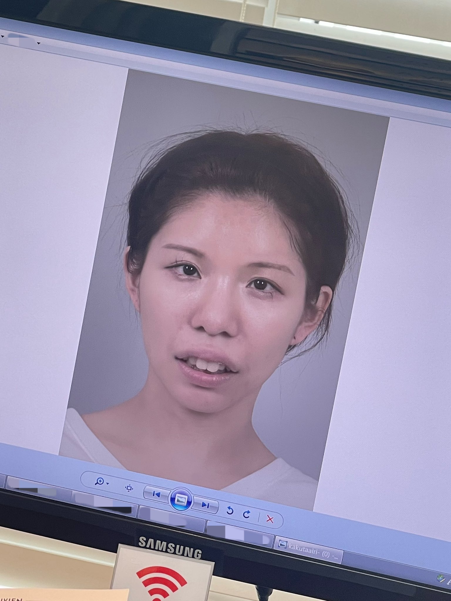 Airi đã tích cóp tiền suốt nhiều năm để có thể thực hiện ước mơ thẩm mỹ, thay đổi diện mạo.