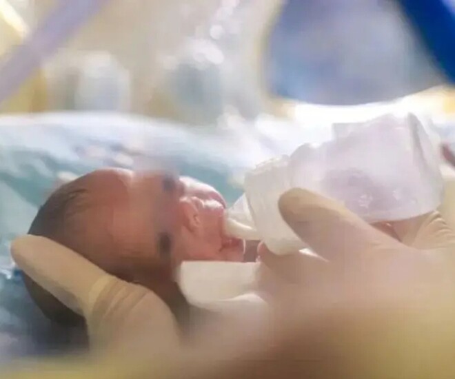 Em bé chào đời với cân nặng 255 gram, bằng một quả táo.