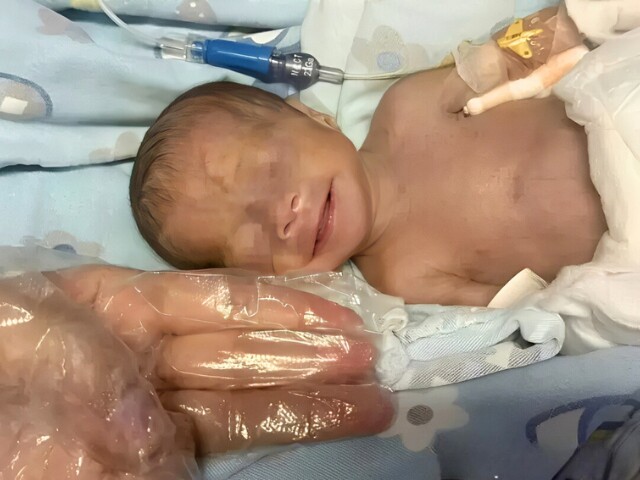 Em bé trải qua 128 ngày giành lại sự sống, gặp nhiều vấn đề sức khỏe.