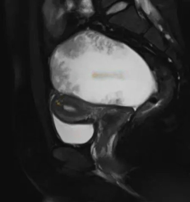 Kết quả siêu âm của bệnh nhân khiến bác sĩ bất ngờ.