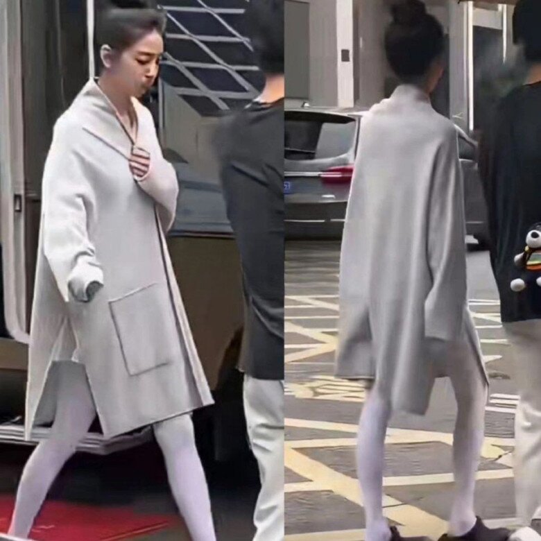 Đôi chân tong teo, không thấy chút da thịt nào còn được cư dân mạng xứ Trung so sánh với “hai sào tre”.