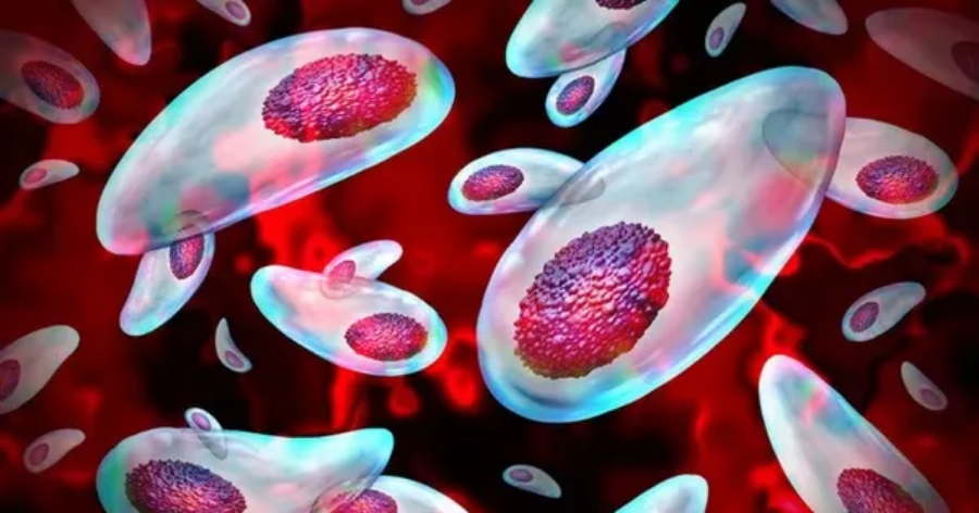 Một loại ký sinh có thể cắt đứt tinh trùng của con người, nguyên nhân gây vô sinh toàn cầu?- Ảnh 1.