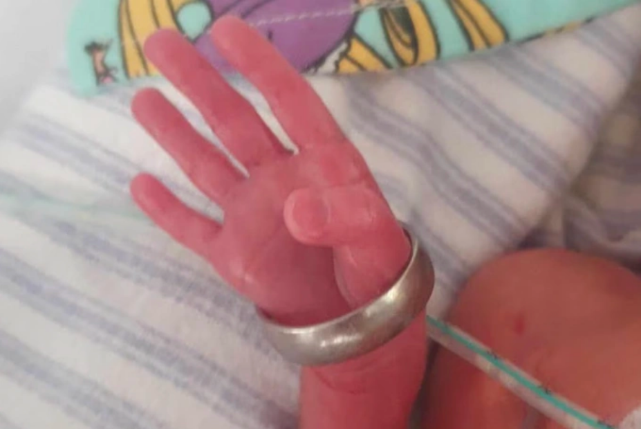Bức ảnh bàn tay của bé Beatrix lột vừa nhẫn cưới của mẹ. Ảnh: AU News
