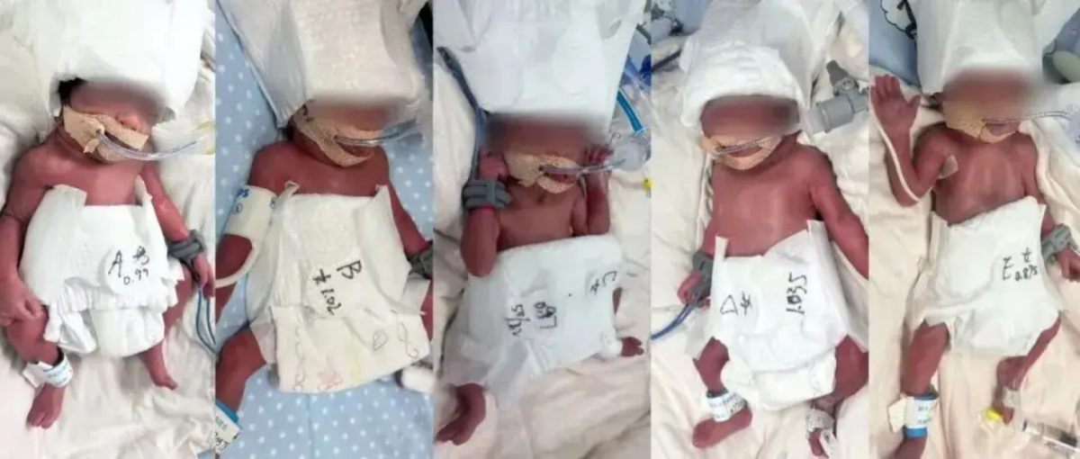 5 em bé đáng yêu lúc mới chào đời.